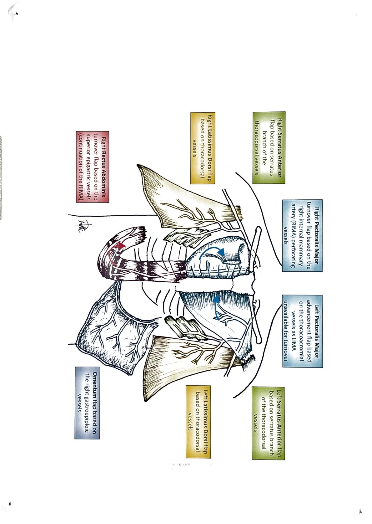 Diagram of chest wall reconstruction flap options and their vascular supply